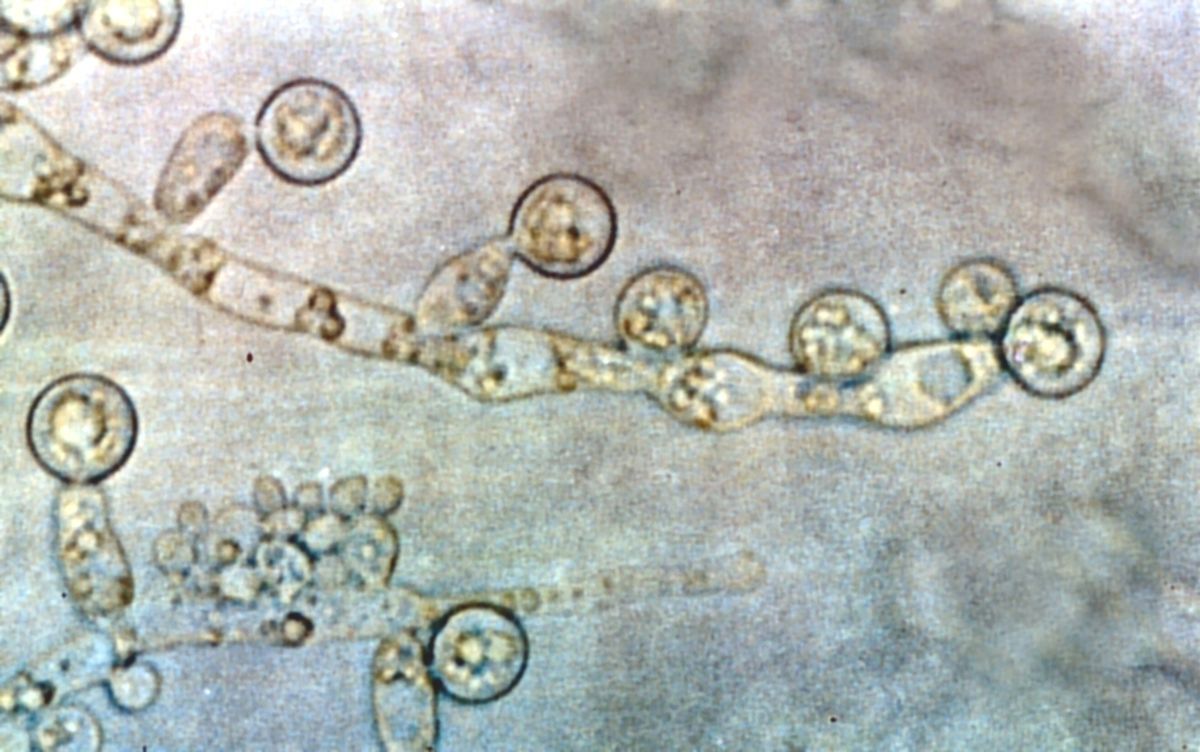 Bệnh nấm diều do một loại nấm có tên gọi Candida albicans gây ra