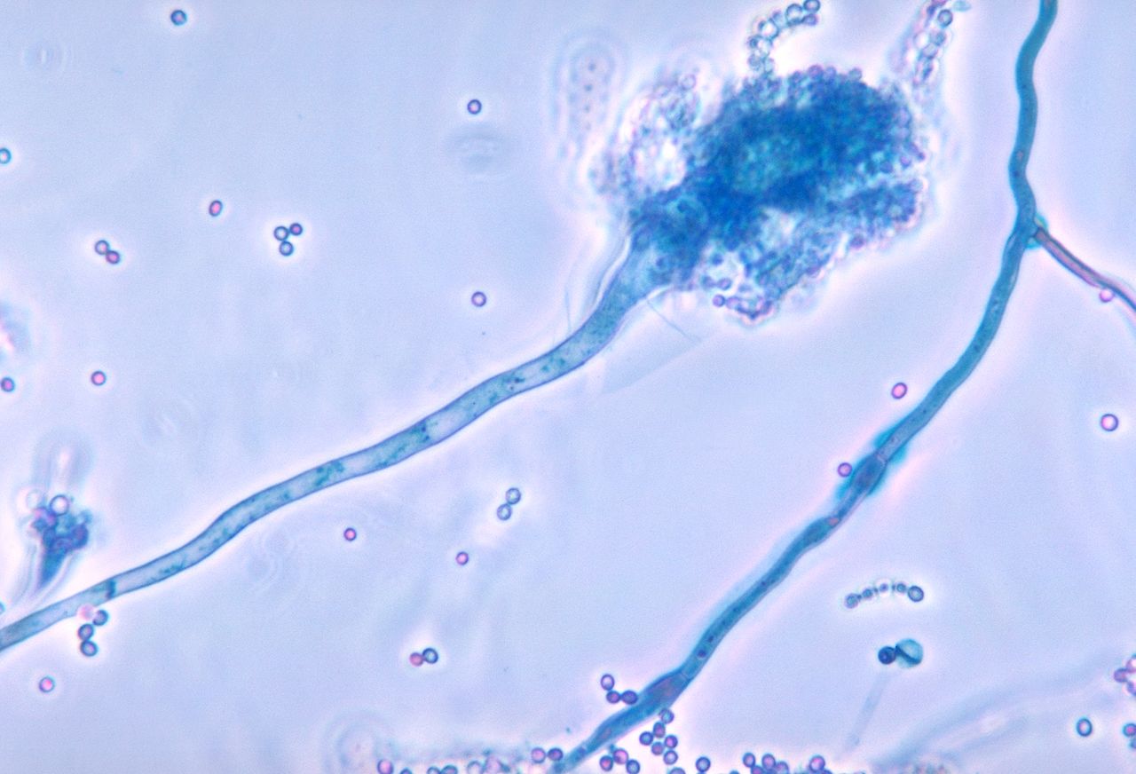 Nấm là tác nhân gây bệnh hô hấp cho đà điểu, đặc biệt là Aspergillus fumigatus